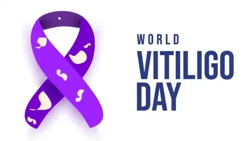 World Vitiligo Day 2026: Raising Awareness and Breaking Myths